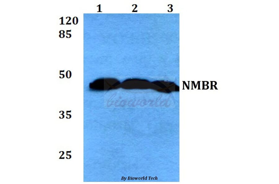 Anti-NMBR (L264) Antibody from Bioworld Technology (BS2737) - Antibodies.com