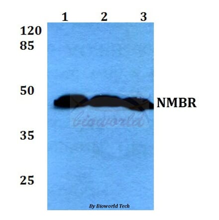 Anti-NMBR (L264) Antibody from Bioworld Technology (BS2737) - Antibodies.com