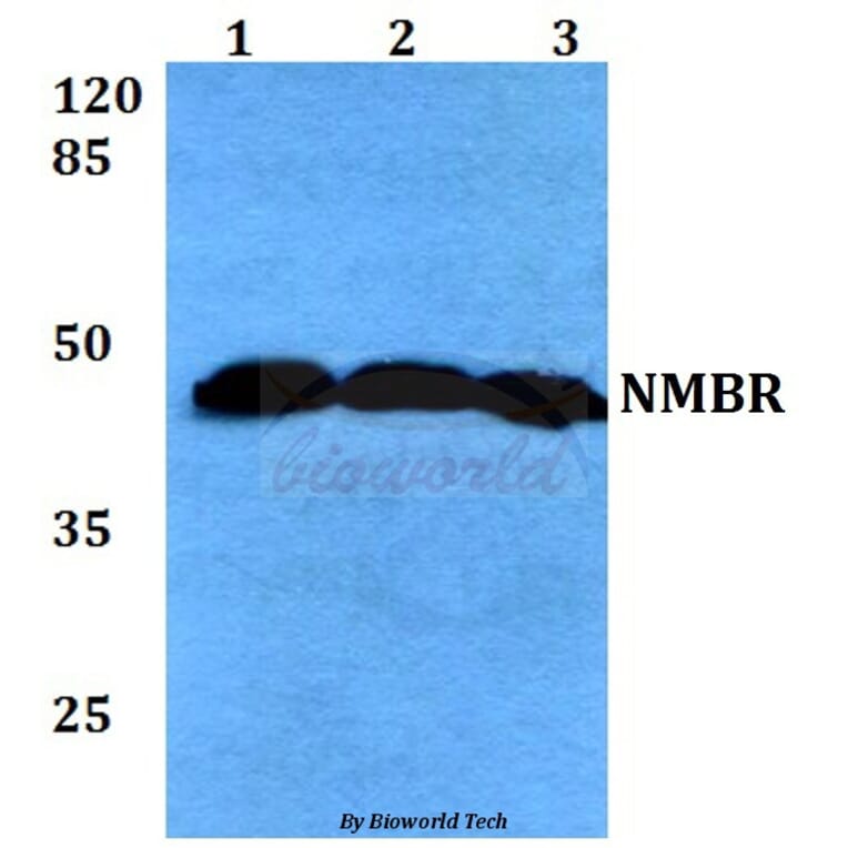 Anti-NMBR (L264) Antibody from Bioworld Technology (BS2737) - Antibodies.com