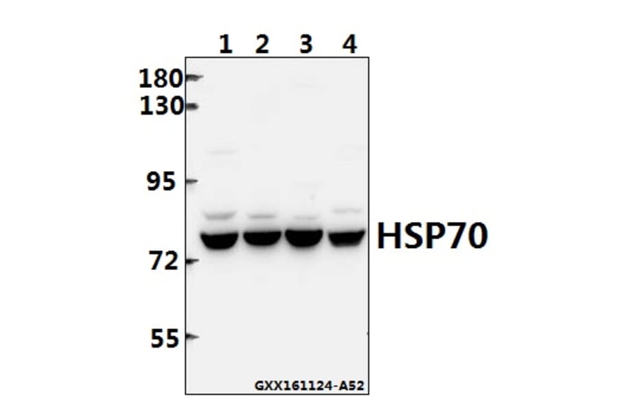 Anti-HSP70 (Y41) Antibody from Bioworld Technology (BS2741) - Antibodies.com