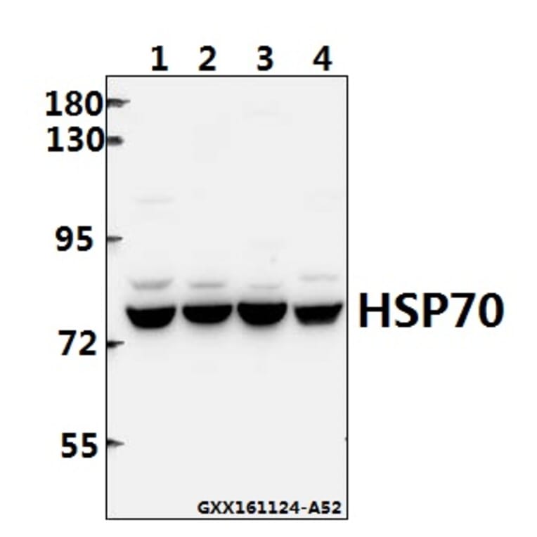 Anti-HSP70 (Y41) Antibody from Bioworld Technology (BS2741) - Antibodies.com