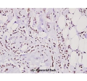 Anti-hnRNP M (P43) Antibody from Bioworld Technology (BS2748) - Antibodies.com