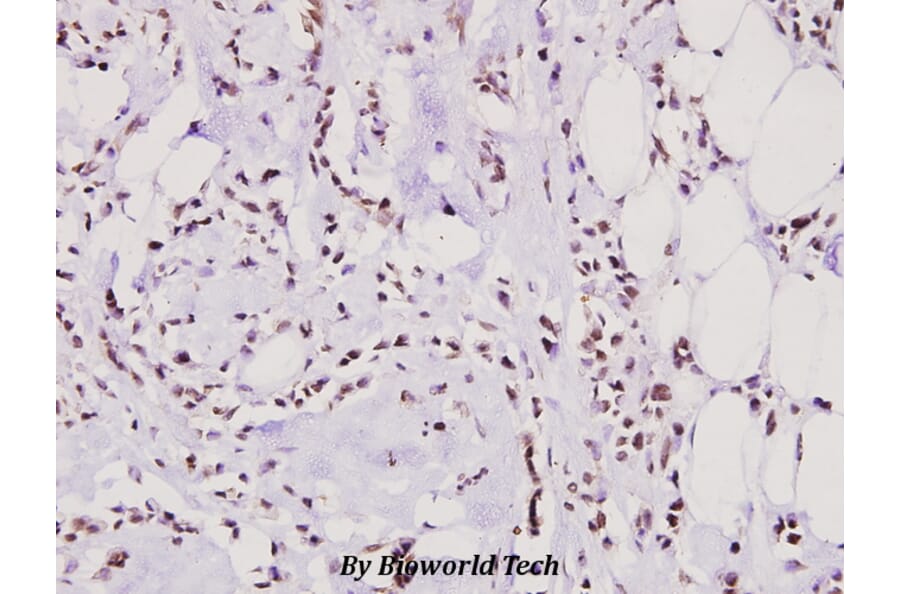 Anti-hnRNP M (P43) Antibody from Bioworld Technology (BS2748) - Antibodies.com