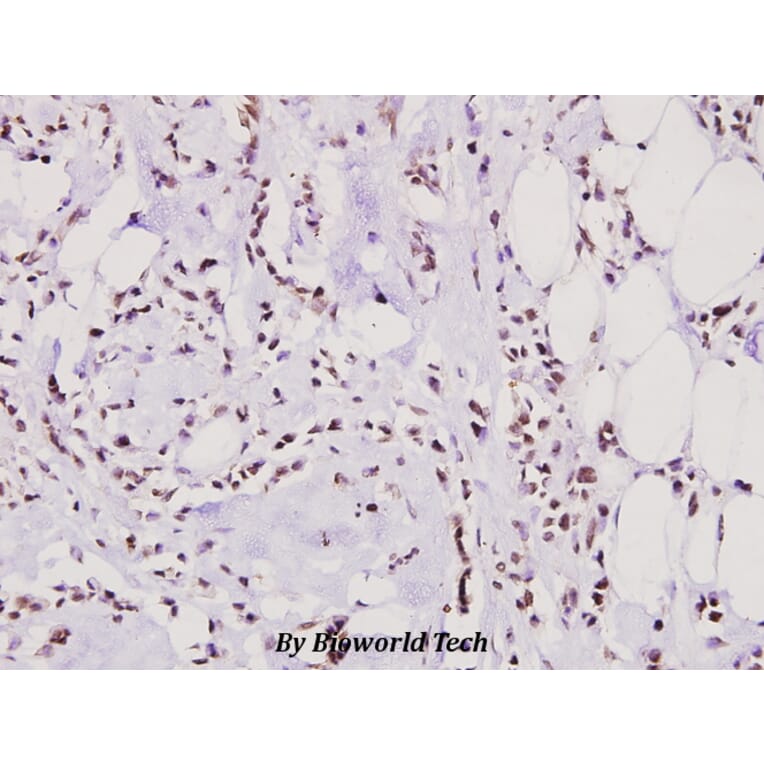 Anti-hnRNP M (P43) Antibody from Bioworld Technology (BS2748) - Antibodies.com