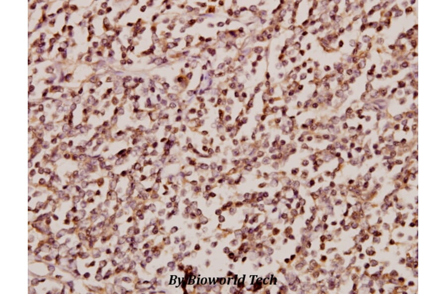 Anti-SRp75 (D134) Antibody from Bioworld Technology (BS2750) - Antibodies.com