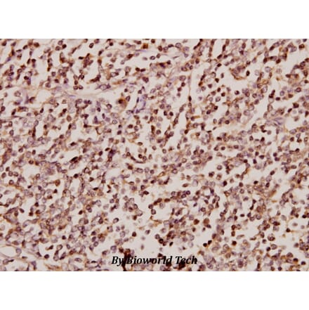 Anti-SRp75 (D134) Antibody from Bioworld Technology (BS2750) - Antibodies.com