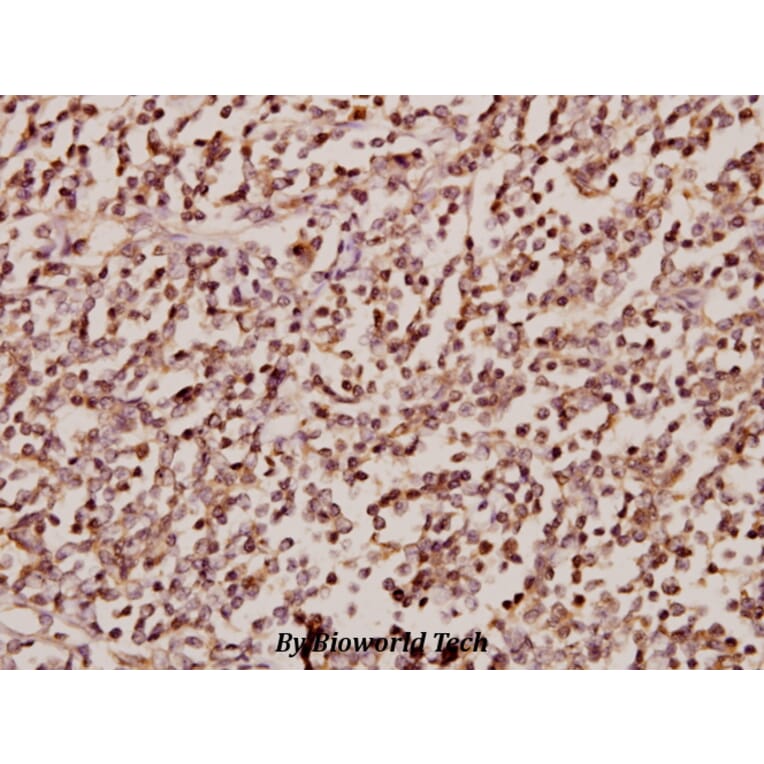 Anti-SRp75 (D134) Antibody from Bioworld Technology (BS2750) - Antibodies.com