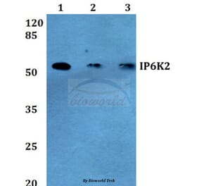 Anti-IP6K2 (L188) Antibody from Bioworld Technology (BS2759) - Antibodies.com