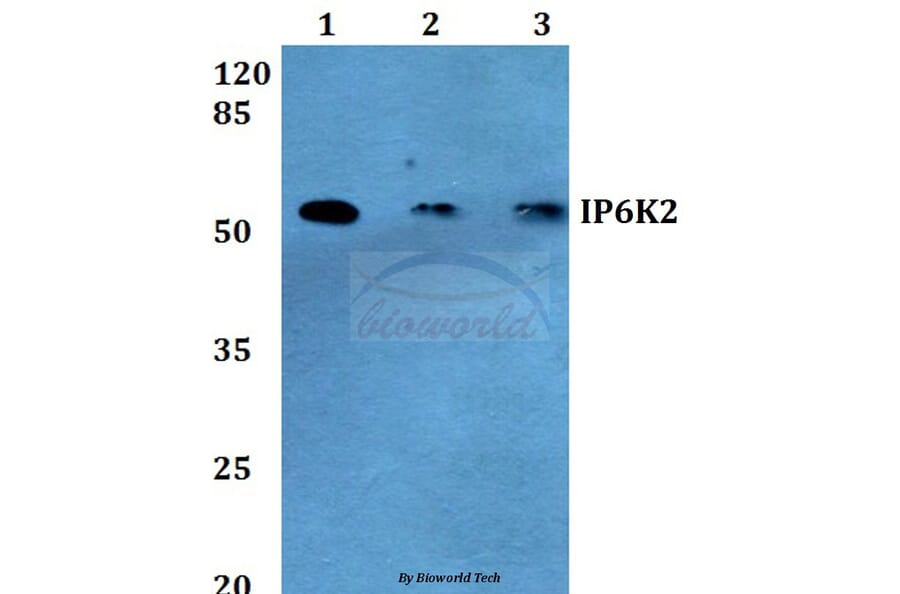 Anti-IP6K2 (L188) Antibody from Bioworld Technology (BS2759) - Antibodies.com