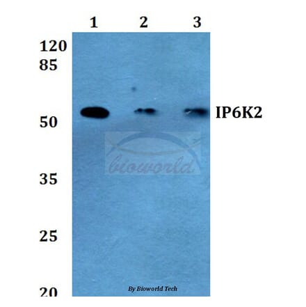 Anti-IP6K2 (L188) Antibody from Bioworld Technology (BS2759) - Antibodies.com