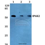 Anti-IP6K2 (L188) Antibody from Bioworld Technology (BS2759) - Antibodies.com