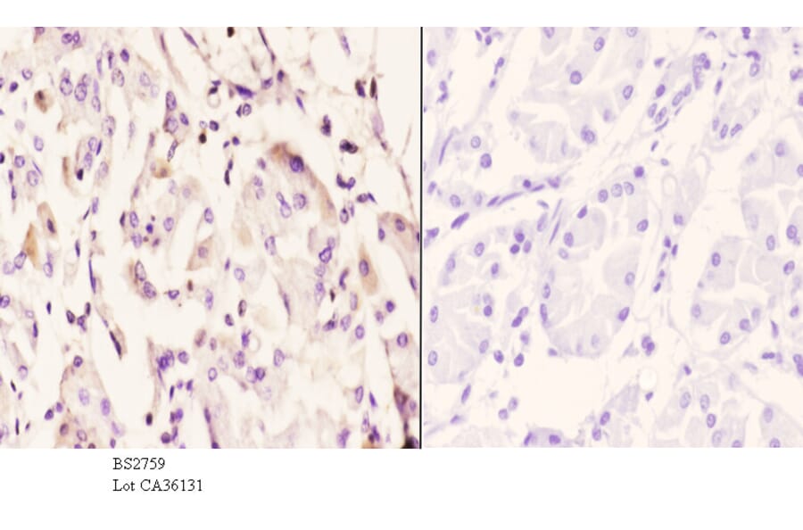 Anti-IP6K2 (L188) Antibody from Bioworld Technology (BS2759) - Antibodies.com