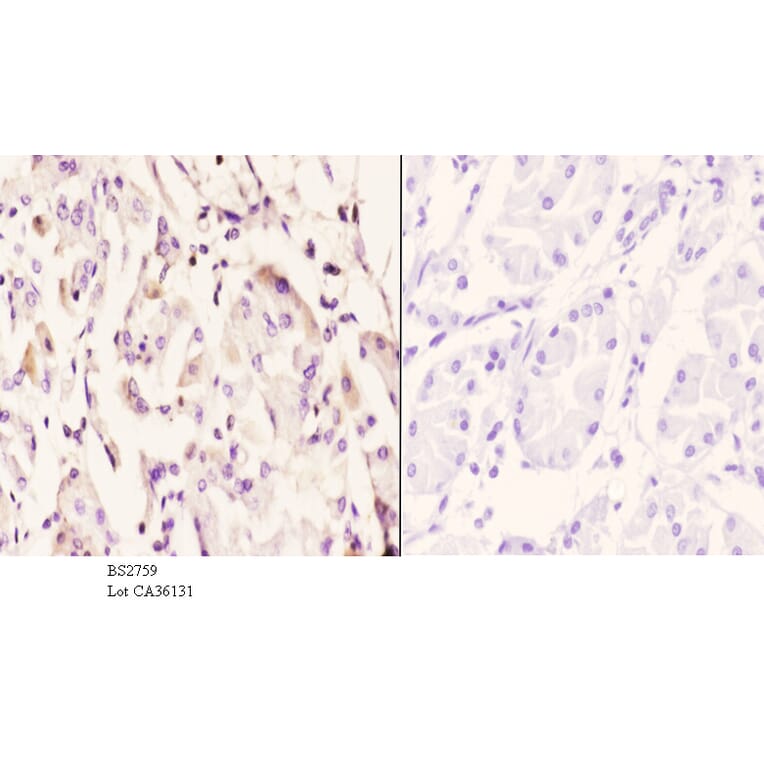 Anti-IP6K2 (L188) Antibody from Bioworld Technology (BS2759) - Antibodies.com