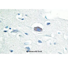 Anti-IRAK-M (L519) Antibody from Bioworld Technology (BS2761) - Antibodies.com