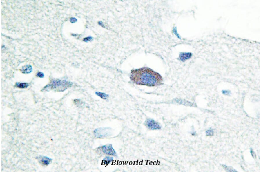 Anti-IRAK-M (L519) Antibody from Bioworld Technology (BS2761) - Antibodies.com
