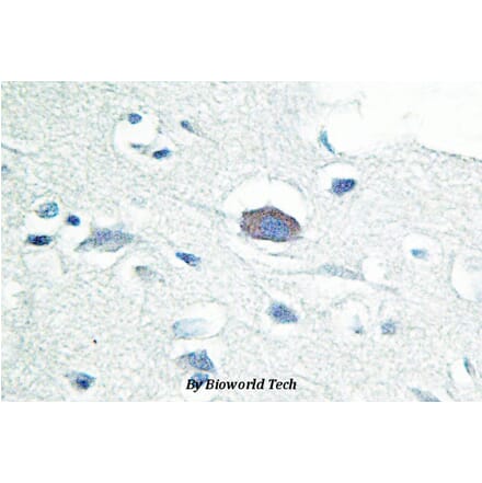 Anti-IRAK-M (L519) Antibody from Bioworld Technology (BS2761) - Antibodies.com