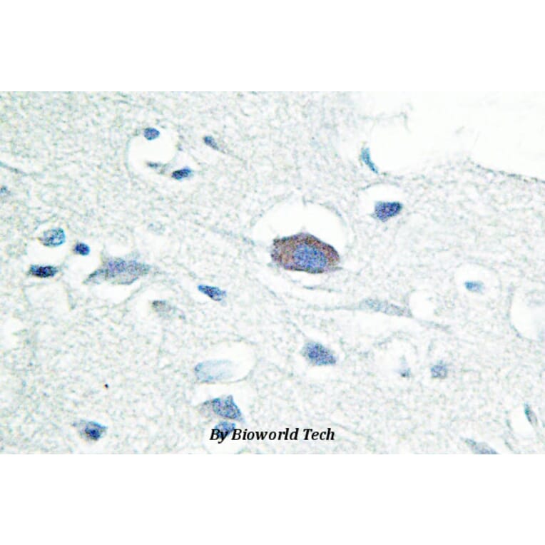 Anti-IRAK-M (L519) Antibody from Bioworld Technology (BS2761) - Antibodies.com