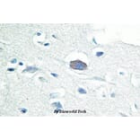Anti-IRAK-M (L519) Antibody from Bioworld Technology (BS2761) - Antibodies.com