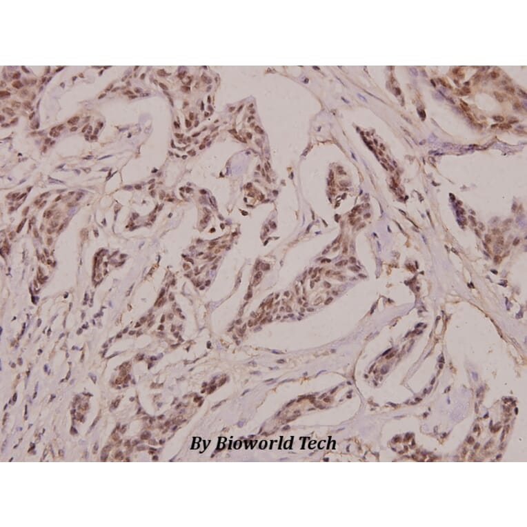 Anti-Laminin β-2 (C91) Antibody from Bioworld Technology (BS2764) - Antibodies.com