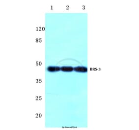 Anti-BRS-3 (C203) Antibody from Bioworld Technology (BS2769) - Antibodies.com