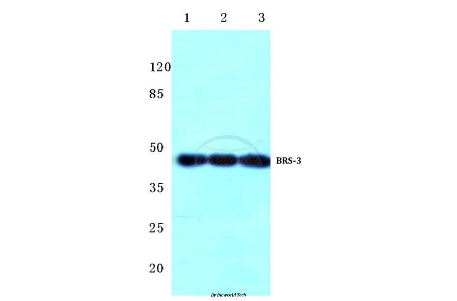 Anti-BRS-3 (C203) Antibody from Bioworld Technology (BS2769) - Antibodies.com