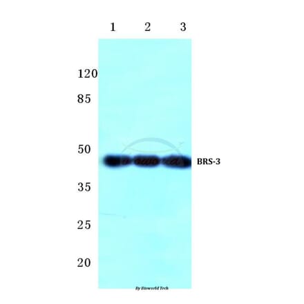Anti-BRS-3 (C203) Antibody from Bioworld Technology (BS2769) - Antibodies.com