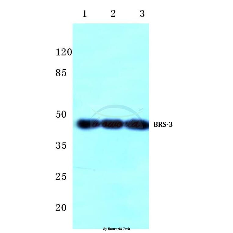 Anti-BRS-3 (C203) Antibody from Bioworld Technology (BS2769) - Antibodies.com