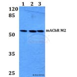Anti-mAChR M2 (P224) Antibody from Bioworld Technology (BS2781) - Antibodies.com