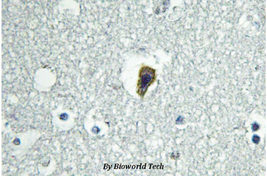 Anti-BAI-1 (Q732) Antibody from Bioworld Technology (BS2784) - Antibodies.com