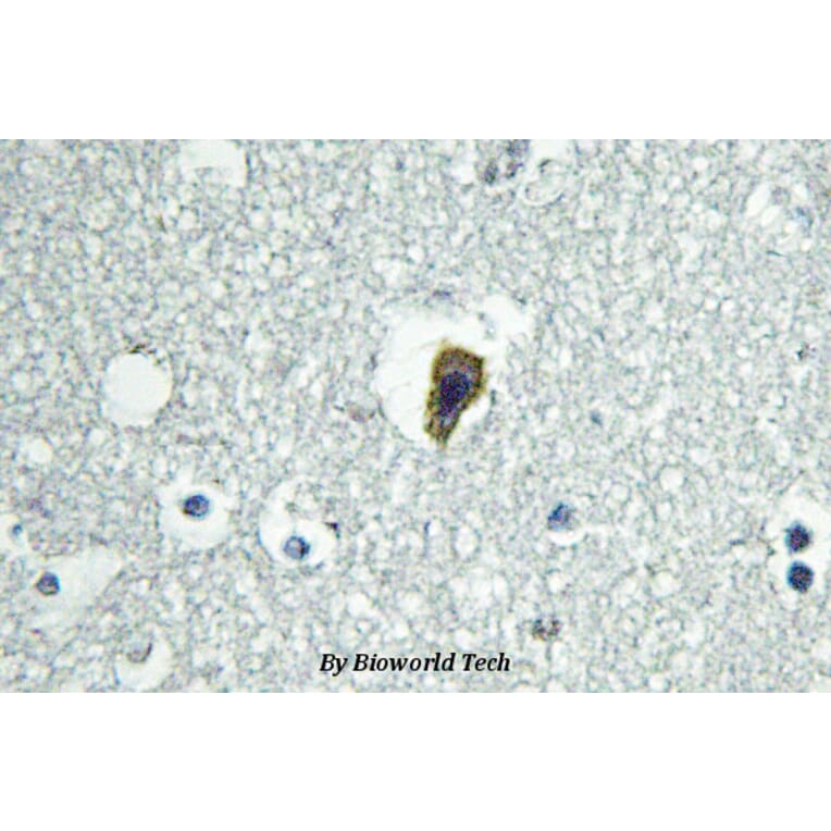 Anti-BAI-1 (Q732) Antibody from Bioworld Technology (BS2784) - Antibodies.com