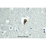 Anti-BAI-1 (Q732) Antibody from Bioworld Technology (BS2784) - Antibodies.com