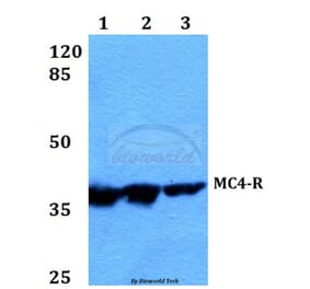 Anti-MC4-R (E315) Antibody from Bioworld Technology (BS2811) - Antibodies.com