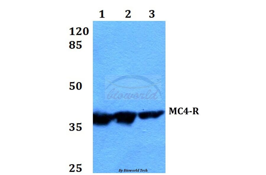 Anti-MC4-R (E315) Antibody from Bioworld Technology (BS2811) - Antibodies.com