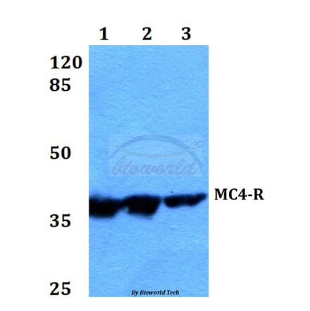 Anti-MC4-R (E315) Antibody from Bioworld Technology (BS2811) - Antibodies.com