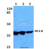 Anti-MC4-R (E315) Antibody from Bioworld Technology (BS2811) - Antibodies.com