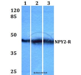 Anti-NPY2-R (D42) Antibody from Bioworld Technology (BS2818) - Antibodies.com