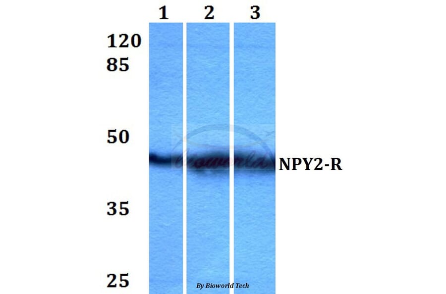 Anti-NPY2-R (D42) Antibody from Bioworld Technology (BS2818) - Antibodies.com