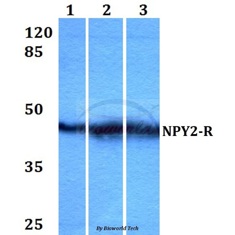 Anti-NPY2-R (D42) Antibody from Bioworld Technology (BS2818) - Antibodies.com