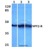 Anti-NPY2-R (D42) Antibody from Bioworld Technology (BS2818) - Antibodies.com