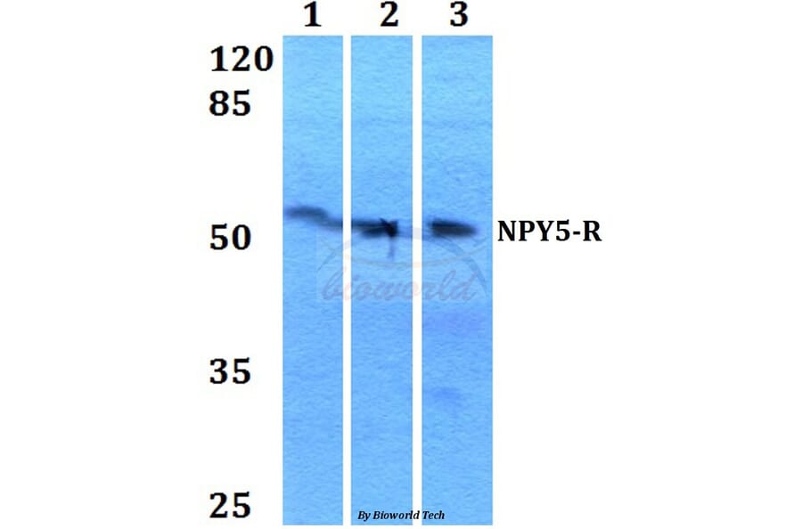 Anti-NPY5-R (M264) Antibody from Bioworld Technology (BS2819) - Antibodies.com
