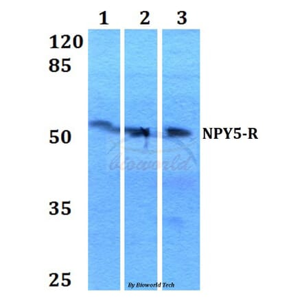 Anti-NPY5-R (M264) Antibody from Bioworld Technology (BS2819) - Antibodies.com