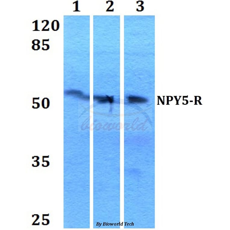 Anti-NPY5-R (M264) Antibody from Bioworld Technology (BS2819) - Antibodies.com