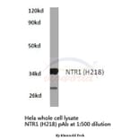 Anti-NTR1 (H218) Antibody from Bioworld Technology (BS2820) - Antibodies.com