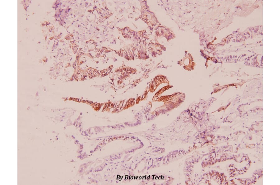 Anti-PI3K p85β (Q496) Antibody from Bioworld Technology (BS2827) - Antibodies.com