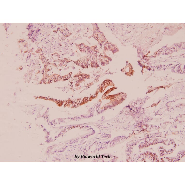 Anti-PI3K p85β (Q496) Antibody from Bioworld Technology (BS2827) - Antibodies.com