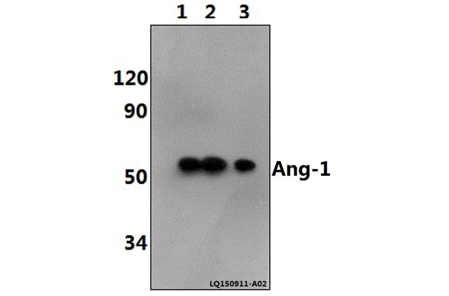 Anti-Ang-1 (E207) Antibody from Bioworld Technology (BS2829) - Antibodies.com