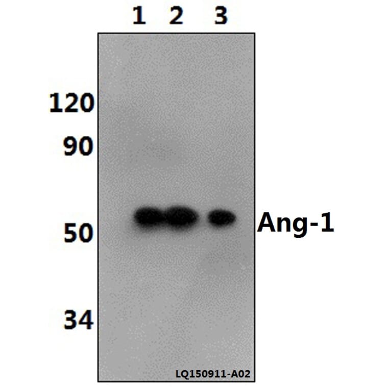 Anti-Ang-1 (E207) Antibody from Bioworld Technology (BS2829) - Antibodies.com