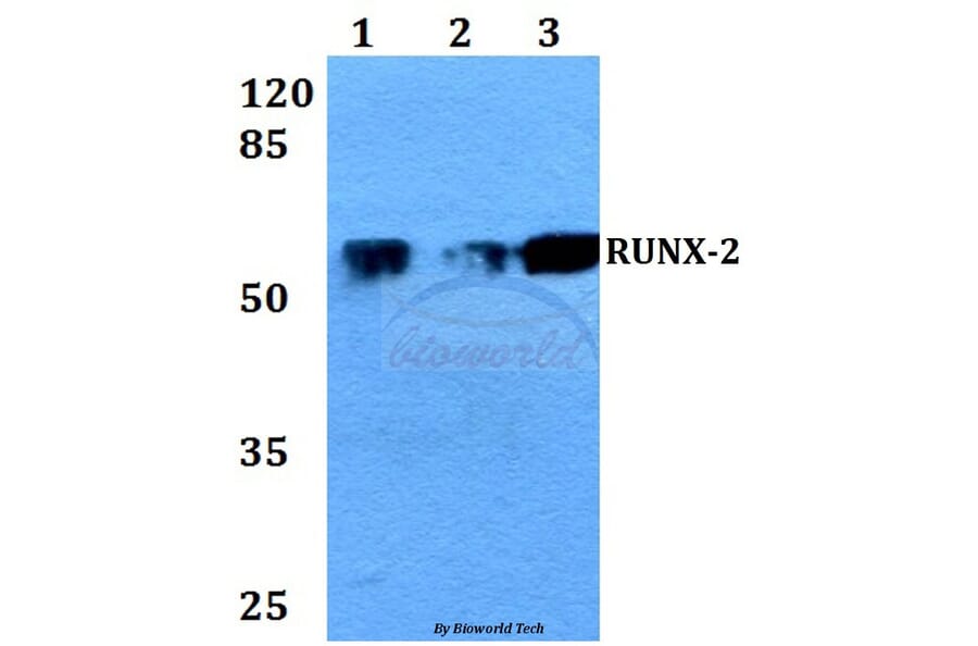 Anti-RUNX-2 (N278) Antibody from Bioworld Technology (BS2831) - Antibodies.com