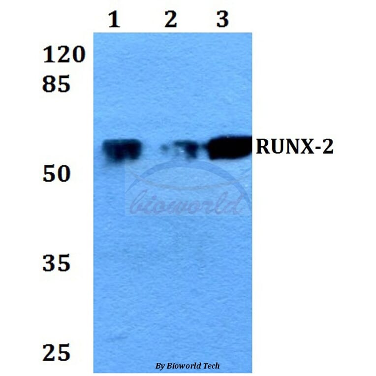 Anti-RUNX-2 (N278) Antibody from Bioworld Technology (BS2831) - Antibodies.com