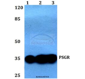 Anti-PSGR (F237) Antibody from Bioworld Technology (BS2837) - Antibodies.com
